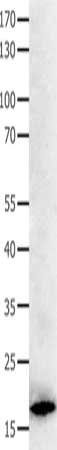 Gel: 10+12+15%SDS-PAGE, Lysate: 40 ug, Lane: Hela cells, Primary antibody: CSB-PA574023(BCL2L15 Antibody) at dilution 1/1100, Secondary antibody: Goat anti rabbit IgG at 1/8000 dilution, Exposure time: 20 seconds