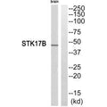 Western blot analysis of extracts from mouse brain cells, using STK17B antibody.