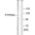 Western blot analysis of extracts from NIH/3T3 cells, using PTPRN2 antibody.