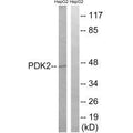 Western blot analysis of extracts from HepG2 cells, using PDK2 antibody.