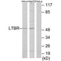 Western blot analysis of extracts from HeLa cells and HepG2 cells, using LTBR antibody.