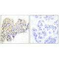 Immunohistochemical analysis of paraffin-embedded human breast carcinoma tissue using HSP90B (Ab-254) antibody.