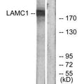Western blot analysis of extracts from HUVEC cells, using LAMC1 antibody.