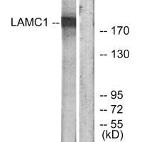 Western blot analysis of extracts from HUVEC cells, using LAMC1 antibody.