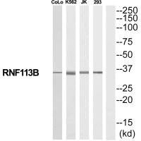 Western blot analysis of extracts from COLO205/K562/Jurkat/293 cells, using RNF113B antibody.