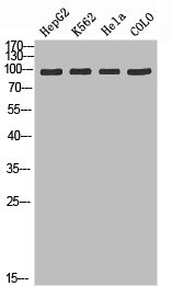 Western blot analysis of HepG2 K562 Hela Colo using ADAMTS-2 antibody.. Secondary antibody  was diluted at 1:20000