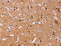 The image on the left is immunohistochemistry of paraffin-embedded Human brain tissue using CSB-PA576885(CHRM1 Antibody) at dilution 1/20, on the right is treated with fusion protein. (Original magnification: ×200)