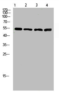 Western Blot analysis of 1,mouse-lung 2,mouse-brain 3,mouse-spleen 4,mouse-kidney cells using primary antibody diluted at 1:500(4°C overnight). Secondary antibody:Goat Anti-rabbit IgG IRDye 800( diluted at 1:5000, 25°C, 1 hour)
