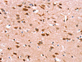 The image on the left is immunohistochemistry of paraffin-embedded Human brain tissue using CSB-PA576969(GH1 Antibody) at dilution 1/40, on the right is treated with synthetic peptide. (Original magnification: ×200)