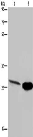 Gel: 8%SDS-PAGE, Lysate: 40 ug, Lane 1-2: Human hepatocellular carcinoma tissue, mouse skeletal muscle tissue, Primary antibody: CSB-PA577055(CA3 Antibody) at dilution 1/200, Secondary antibody: Goat anti rabbit IgG at 1/8000 dilution, Exposure time: 5 minutes
