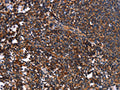 The image on the left is immunohistochemistry of paraffin-embedded Human tonsil tissue using CSB-PA577153(SYT4 Antibody) at dilution 1/60, on the right is treated with fusion protein. (Original magnification: ×200)