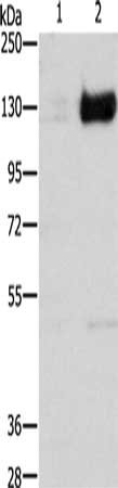 Gel: 8%SDS-PAGE, Lysate: 40 ug, Lane 1-2: 293T cells untreated with cobalt chloride, 293T cells treated with cobalt chloride (0.1 mM for 4 hours), Primary antibody: CSB-PA578243(HIF1A Antibody) at dilution 1/750, Secondary antibody: Goat anti rabbit IgG at 1/8000 dilution, Exposure time: 2 minutes