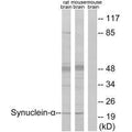 Western blot analysis of extracts from rat brain and mouse brain, using Synuclein-α (Ab-125) antibody.
