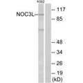 Western blot analysis of extracts from K562 cells, using NOC3L antibody.