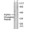 Western blot analysis of extracts from HepG2 cells, using FGFR1 Oncogene Partner antibody.