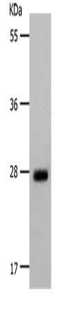 Gel: 10%SDS-PAGE, Lysate: 40 ug, Lane: Human fetal brain tissue, Primary antibody: CSB-PA580752(POMC(Alpha-MSH) Antibody) at dilution 1/350, Secondary antibody: Goat anti rabbit IgG at 1/8000 dilution, Exposure time: 2 minutes