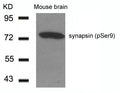 Western blot analysis of extracts from Mouse Brain tissue using synapsin(Phospho-Ser9) Antibody.