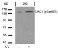 Western blot analysis of extracts from 293 cells untreated or treated with UV using SMC1(Phospho-Ser957) Antibody.