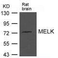 Western blot analysis of extract from Rat brain tissue using MELK Antibody
