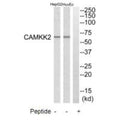Western blot analysis of extracts from HuvEc cells and HepG2 cells, using CAMKK2 antibody.