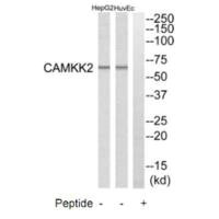 Western blot analysis of extracts from HuvEc cells and HepG2 cells, using CAMKK2 antibody.