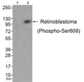 Western blot analysis of extracts from JK cells (Lane 2), using Retinoblastoma (Phospho-Ser608) Antibody. The lane on the left is treated with antigen-specific peptide.