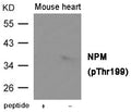Western blot analysis of extracts from  Mouse heart tissue using NPM (Phospho-Thr199) Antibody.The lane on the left is treated with the antigen-specific peptide.