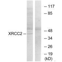 Western blot analysis of extracts from 293cells, using XRCC2 antibody.