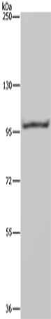 Gel: 6%SDS-PAGE, Lysate: 40 ug, Lane: Raji cells, Primary antibody: CSB-PA583883(NEDD9 Antibody) at dilution 1/650, Secondary antibody: Goat anti rabbit IgG at 1/8000 dilution, Exposure time: 20 seconds