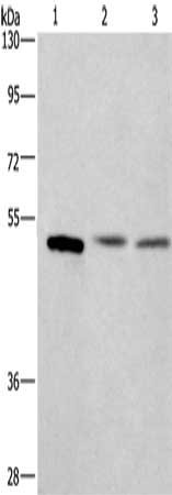 Gel: 10%SDS-PAGE, Lysate: 40 ug, Lane 1-3: Mouse intestinum tenue tissue, human colon cancer tissue, Human testis tissue, Primary antibody: CSB-PA584227(CEP55 Antibody) at dilution 1/350, Secondary antibody: Goat anti rabbit IgG at 1/8000 dilution, Exposure time: 1 minute