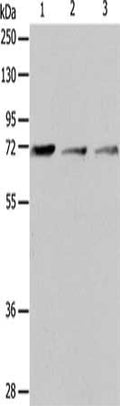 Gel: 10%SDS-PAGE, Lysate: 40 ug, Lane 1-3: RAW264.7 cells, human liver cancer tissue, SP20 cell, Primary antibody: CSB-PA584612(IL18RAP Antibody) at dilution 1/650, Secondary antibody: Goat anti rabbit IgG at 1/8000 dilution, Exposure time: 1 minute