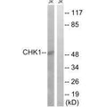 Western blot analysis of extracts from JurKat cells, using Chk1 (Ab-280) antibody.