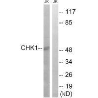 Western blot analysis of extracts from JurKat cells, using Chk1 (Ab-280) antibody.