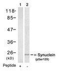 Western blot analysis of extracts from mouse brain tissue using a-Synuclein(Phospho-Ser129) Antibody(Lane 2) and the same antibody preincubated with blocking peptide(Lane1).