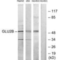 Western blot analysis of extracts from HepG2, 293 and HUVEC cells, using GLU2B antibody.