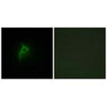 Immunofluorescence analysis of HepG2 cells, using Adrenergic Receptor alpha-2B antibody.