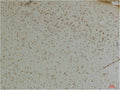Immunohistochemical analysis of paraffin-embedded Mouse BrainTissue using KChIP1 Rabbit pAb diluted at 1:200.