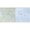 Immunohistochemistry analysis of paraffin-embedded human brain tissue using TTK (Ab-676) antibody.