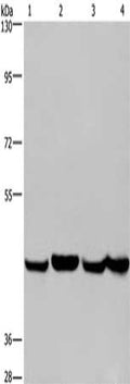 Gel: 6%SDS-PAGE, Lysate: 40 ug, Lane 1-4: A549 cells, Hela cells, PC3 cells, HepG2 cells, Primary antibody: CSB-PA586044(RBMY1A1 Antibody) at dilution 1/350, Secondary antibody: Goat anti rabbit IgG at 1/8000 dilution, Exposure time: 30 seconds