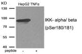 Western blot analysis of extracts from HepG2 cells treated with TNF using IKK- alpha/ beta (Phospho-Ser180/181) antibody.The lane on the right is treated with the antigen-specific peptide.