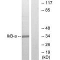 Western blot analysis of extracts from MCF7 cells, treated with TNF-α, using IkappaB-alpha (Ab-32/36) antibody.
