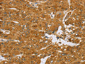 The image on the left is immunohistochemistry of paraffin-embedded Human liver cancer tissue using CSB-PA587516(TNFSF13 Antibody) at dilution 1/40, on the right is treated with synthetic peptide. (Original magnification: ×200)