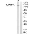 Western blot analysis of extracts from Jurkat cells, using RANBP17 antibody.