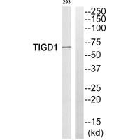 Western blot analysis of extracts from 293 cells, using TIGD1 antibody.