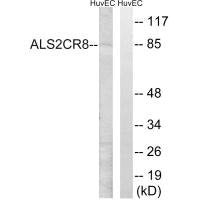 Western blot analysis of extracts from HuvEc cells, using ALS2CR8 antibody.