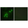 Immunofluorescence analysis of NIH/3T3 cells, using AKAP3 antibody.