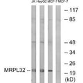 Western blot analysis of extracts from Jurkat cells, MCF-7 cells and HepG2 cells, using MRPL32 antibody.