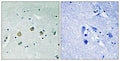 Immunohistochemical analysis of paraffin-embedded human brain tissue using MAP3K8 (Phospho-Ser400) antibody (left)or the same antibody preincubated with blocking peptide (right).
