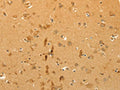 The image on the left is immunohistochemistry of paraffin-embedded Human brain tissue using CSB-PA589025(CFHR1 Antibody) at dilution 1/40, on the right is treated with fusion protein. (Original magnification: ×200)