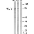 Western blot analysis of extracts from MCF-7 cells and Jurkat cells, using PKC α (Ab-657) antibody.